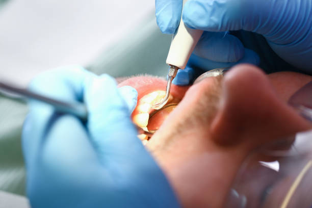 Best Cosmetic Emergency Dentistry in Fletcher, NC